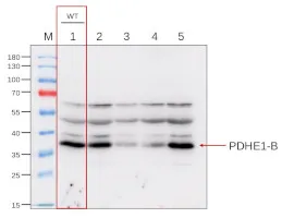 Anti-PDHE1-B | Pyruvate dehydrogenase E1 component subunit b - image 1